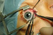 داروی ترمیم کننده ای که به روند بهبود بافت چشم بعد از جراحی سرعت می بخشد