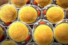 استفاده از ژنتیک سلول های چربی برای پیش بینی پاسخ به داروهای ضد دیابتی