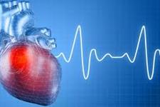 تولید ضربان سازهای قلبی دارای عملکرد