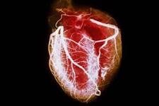 بازسازی عضلات قلبی دارای عملکرد در قلب های انسانی سلول زدایی شده