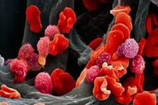 تبدیل سلول های خونی بالغ به سلول های بنیادی خون ساز