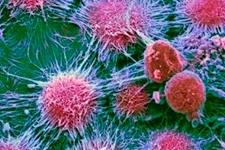 چگونه تومورها سلول های بنیادی را برای حمایت از رشد و پیشرفت شان فراخوانده و استفاده می کنند