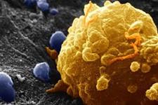 زمانی که چرخه سلولی سریع می شود، سرطان نیز به صورت جهشی افزایش می یابد