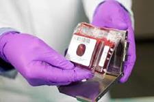 روشی برای تولید آنزیم FTVI و بهبود پیوند خون بند ناف
