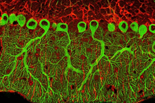 ایجاد ارگانوئیدی مخچه انسانی از سلول‌های بنیادی پرتوان انسانی