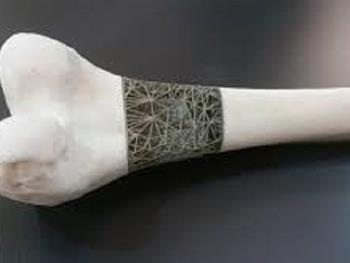 پرینت سه بعدی زنده داربست های استخوان زا درون نواقص استخوانی