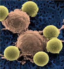 دریافت بودجه18.2‌میلیون دلاری برای مطالعات بالینی سرطان سلول های B
