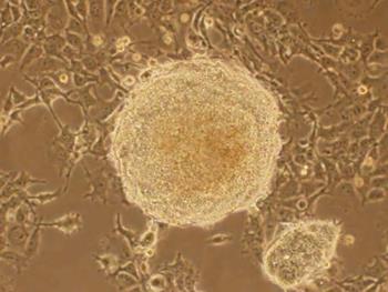 کشت سلول های بنیادی پرتوان القایی بدون استفاده از سلول های فیدر