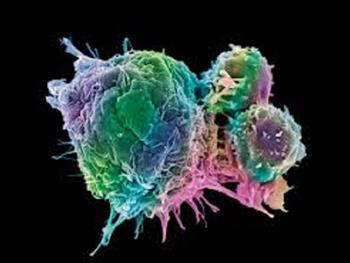 تلاش برای CAR T cell درمانی مولتیپل میلوما