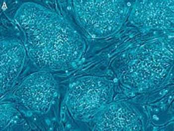 نانوفیبرهای سیلک الکتروریسی شده پتانسیل تمایزی سلول های بنیادی پرتوان القایی انسانی به سلول های تولید کننده انسولین