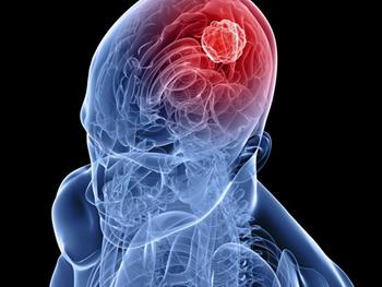 سلول‌های بنیادی خون‌ساز منجر به تهاجمی‌تر شدن سلول‌های سرطانی در مغز می‌شوند