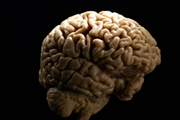 جلوگیری از مرگ سلول‌های بنیادی پیوند شده به مغز