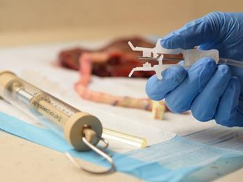 منع قرارداد نمونه‌های خون بندناف به دلیل بیماری تب مدیترانه‌ای