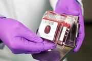 درمان بیماران سرطانی توسط مهندسی سلول‌های ایمنی خون بندناف