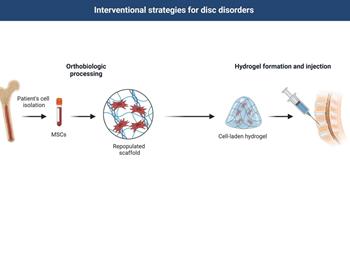 گزینه‌های مدیریت ارتوبیولوژیک برای بیماری دژنراتیو دیسک 