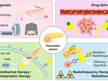 چشم انداز نانوذرات طلا در سرطان پانکراس